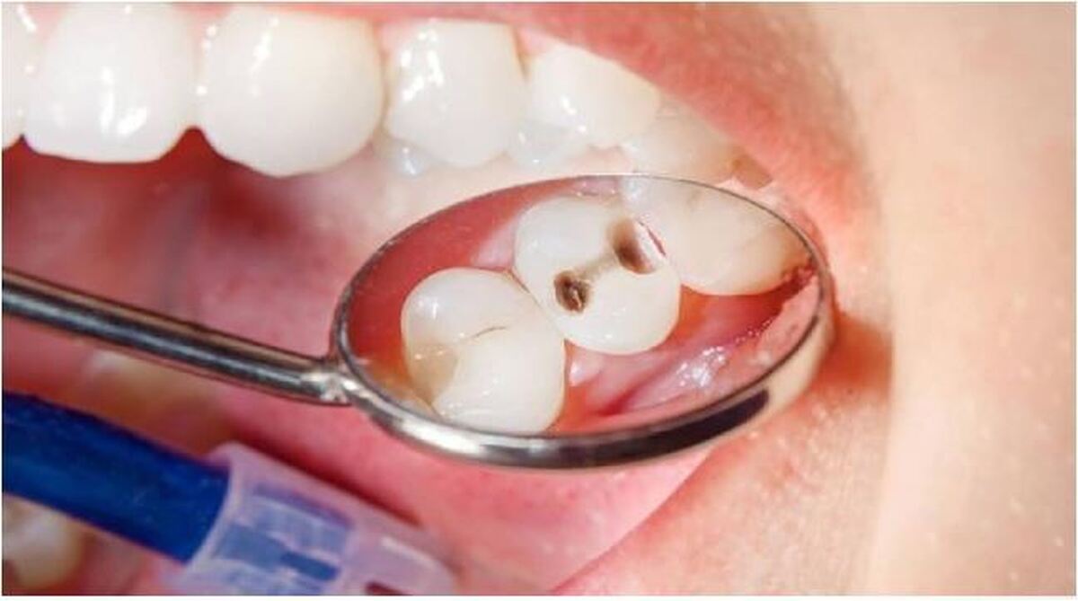 آیا می‌دانستید استرس به پوسیدگی مکرر دندان کمک می‌کند!