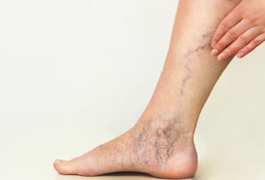 دانستنی‌های مهم درباره علائم پنهان بیماری‌های کبدی