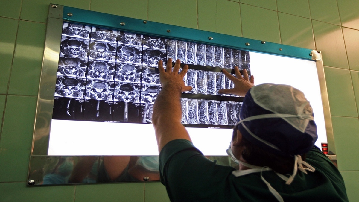 بیش از ۸۰ درصد بیماری‌های ستون فقرات نیاز به عمل جراحی ندارد