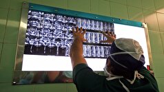 بیش از ۸۰ درصد بیماری‌های ستون فقرات نیاز به عمل جراحی ندارد