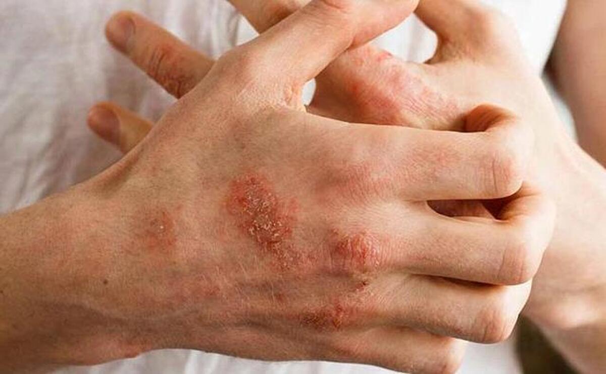 یک ابزار هوش مصنوعی می‌تواند تشخیص سرطان پوست را در مناطق دورافتاده جهان تسریع کند