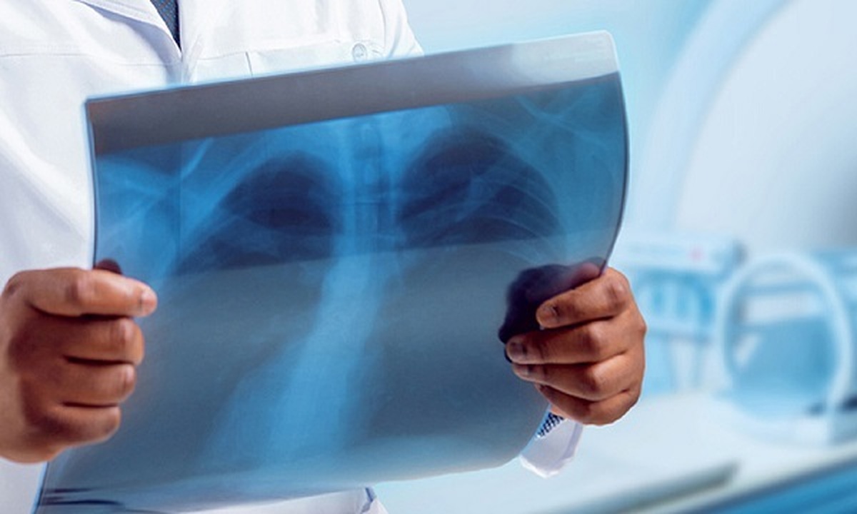 سی‌تی‌اسکن برای کسی ضرر دارد؟