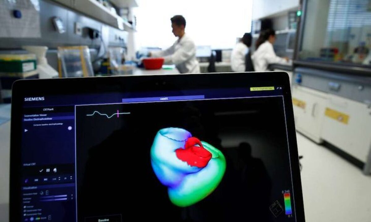 مطالعه: هوش مصنوعی، الکتروکاردیوگرام‌های استاندارد را قادر می‌سازد تا نقص‌های ساختاری را تشخیص دهند