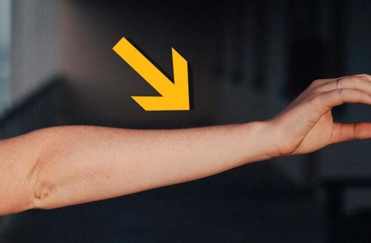 رگ اضافی ساعد انسان‌ها خبر از تکامل میدهد!