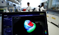 مطالعه: هوش مصنوعی، الکتروکاردیوگرام‌های استاندارد را قادر می‌سازد تا نقص‌های ساختاری را تشخیص دهند