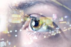 سمنانی‌ها فرزندان‌شان را به تحصیل در رشته‌های مرتبط با چشم‌پزشکی ترغیب کنند