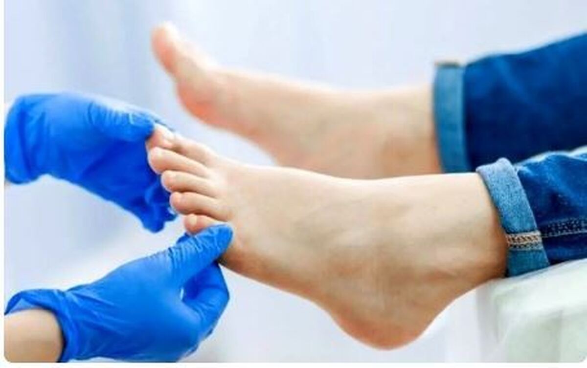 آیا درمان انحراف شست پا بدون جراحی ممکن است؟