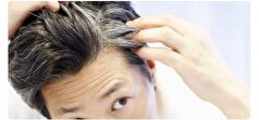 چرا داشتن موی خاکستری در سر نگران کننده است؟