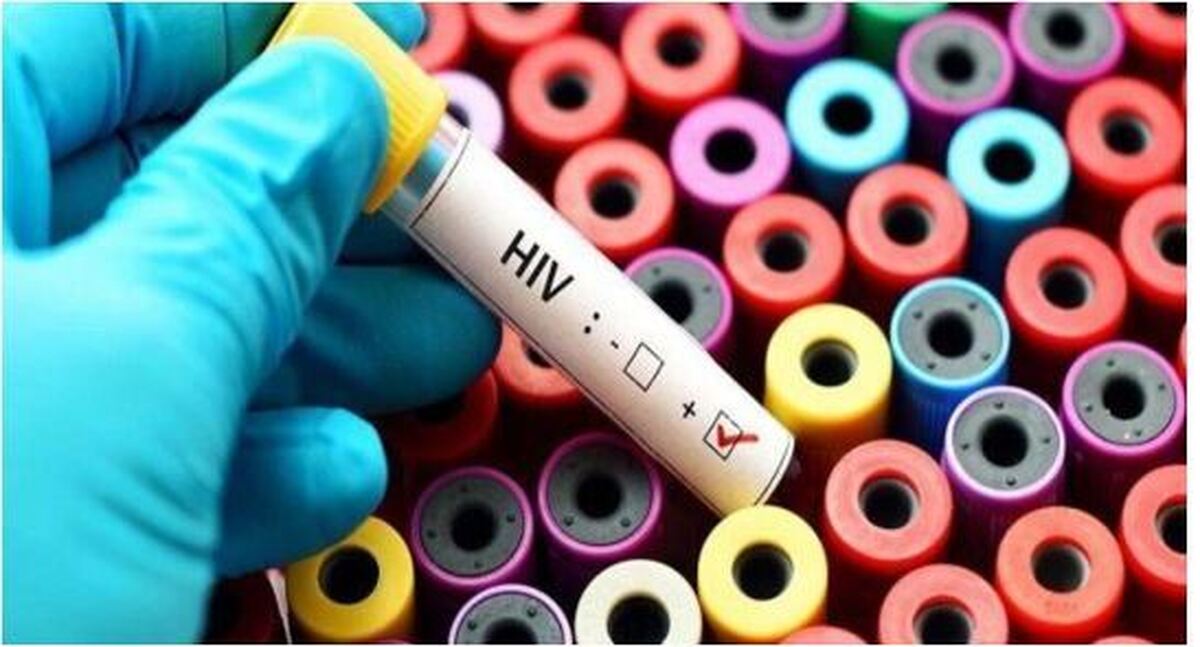 بالا رفتن آمار موارد ابتلا به «اچ‌آی‌وی» در این ۳ کشور نگران کننده شد
