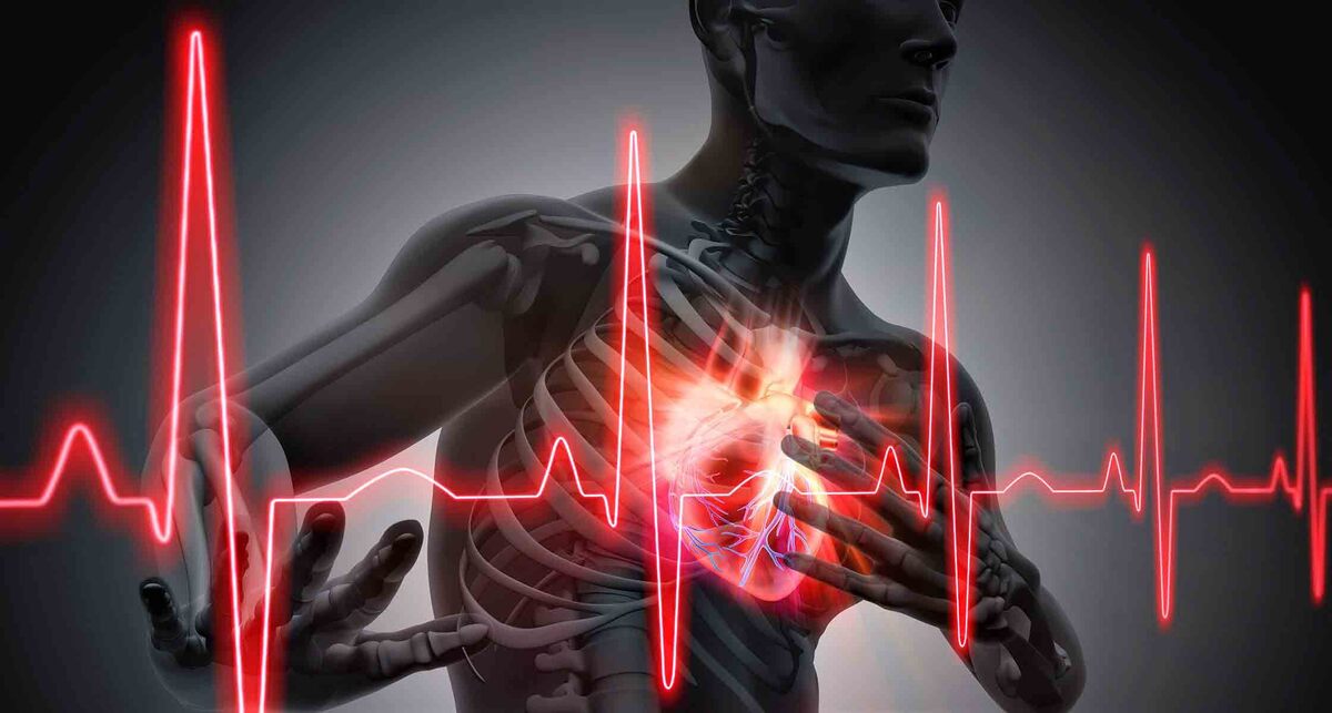 ECLS مرگ و میر را در بیماران مبتلا به حمله قلبی کاهش نمی‌دهد