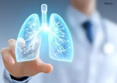 بهبود عملکرد کلی تنفسی در هوای آلوده با ۴ خوراکی