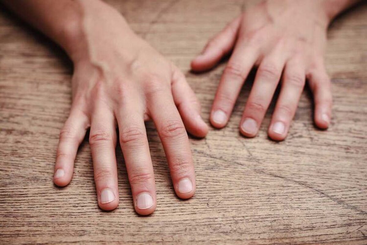 علت سیانوز دست چیست؟