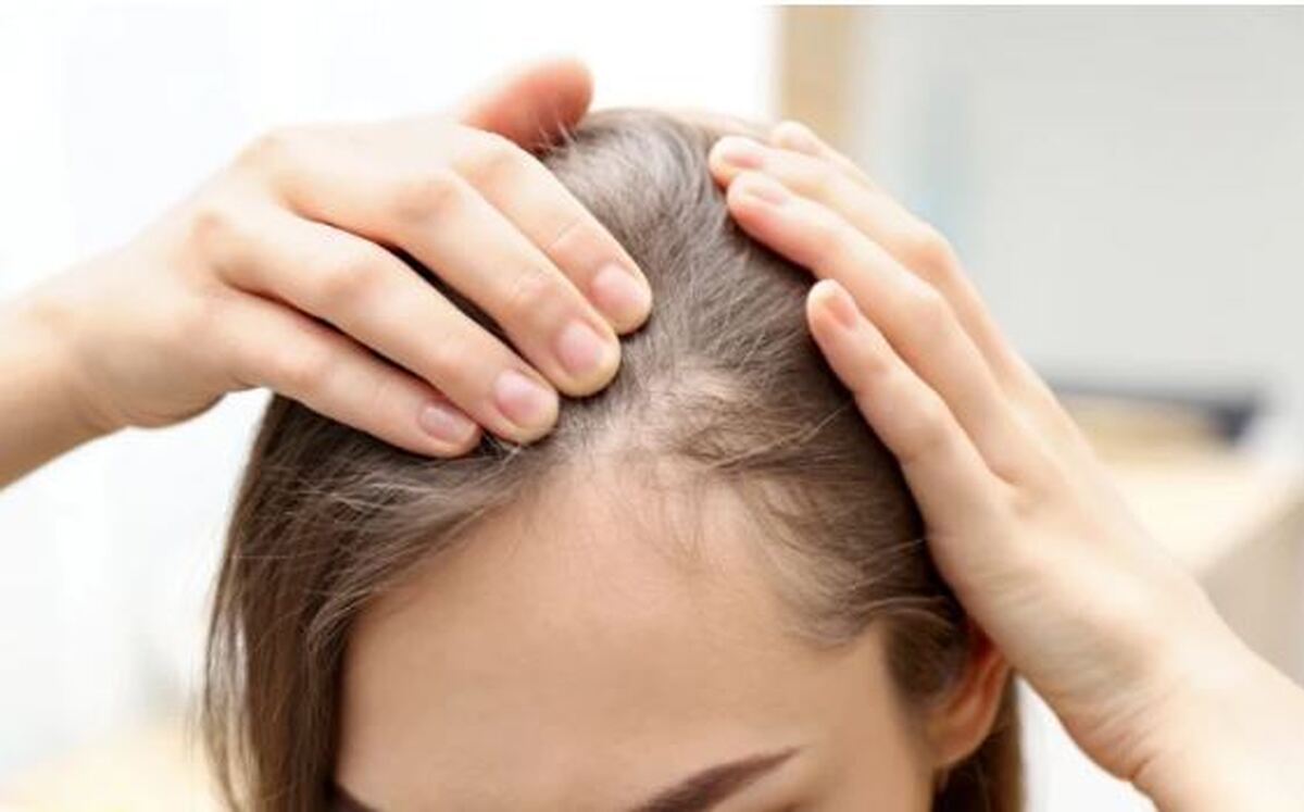 آیا می‌دانستید کلیپس‌های چنگکی باعث ریزش مو می‌شود؟