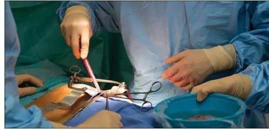 آیا به وجود آمدن کیست کورتیکال در کلیه نگران کننده است؟ آیا به وجود آمدن کیست کورتیکال در کلیه نگران کننده است؟