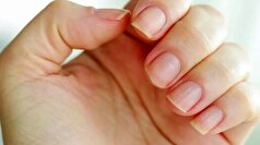 وجود این سبزیجات در بشقاب غذا برای سلامت ناخن‌ها ضروری است!