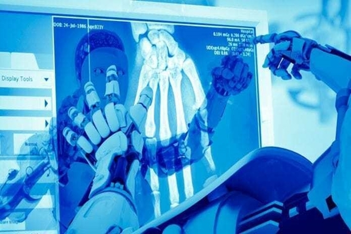 هوش مصنوعی مفید برای کاهش خطا‌ها در رادیولوژی و تصویربرداری پزشکی!
