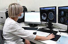 بیماری‌ام‌اس قبل از بروز علائم به مغز حمله می‌کند!