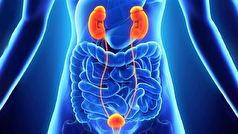 سندرم مثانه بیش‌فعال را با این رژیم از خود دور کنید!