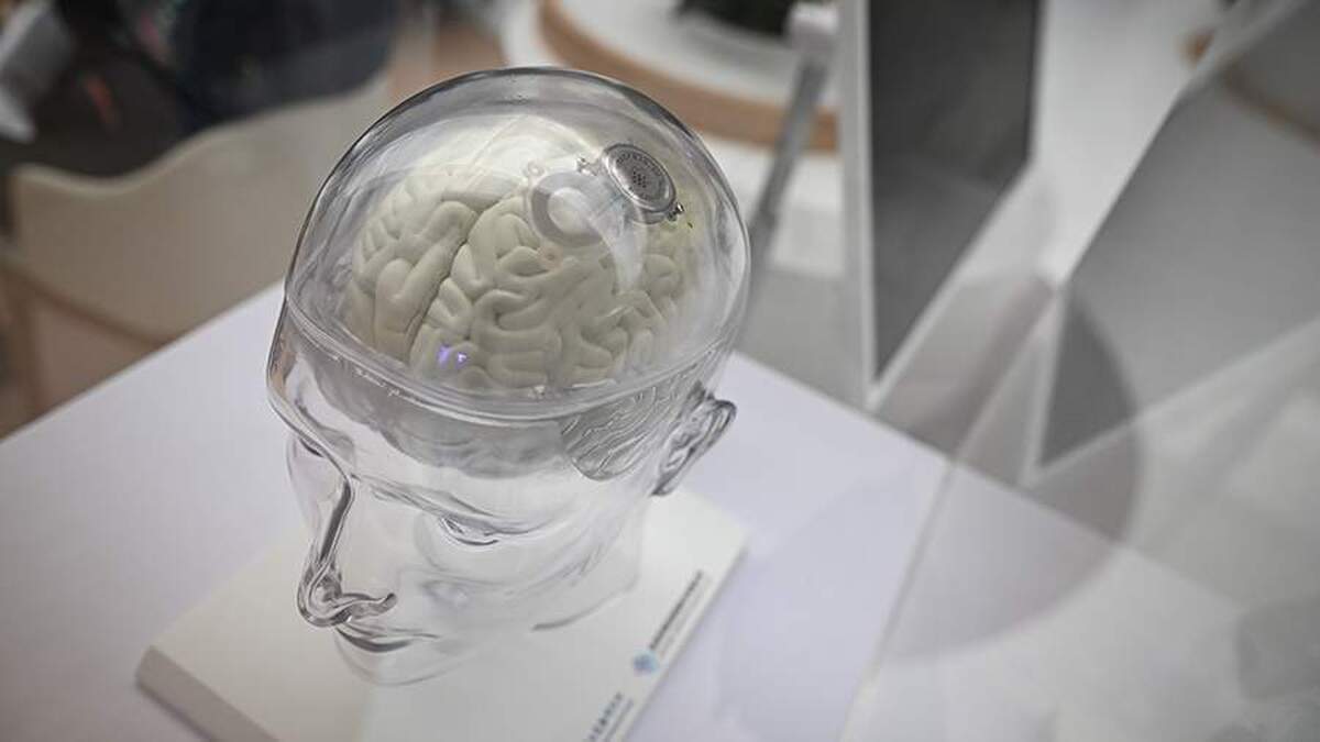 یک پزشک درباره تأثیر تغذیه بر عملکرد مغز صحبت کرد.