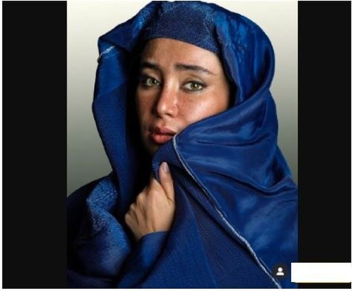 رنگ پوست برنزه و صورت ککی مکی بهاره افشاری در تصویر جدیدش جلب توجه کرد/خانم بازیگر چقدر تغییر کرده..