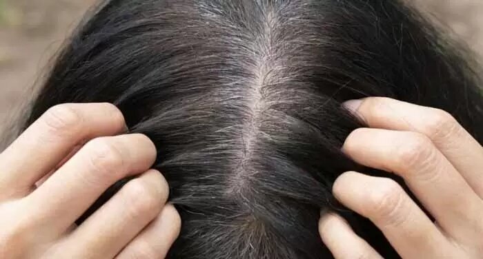 آیا واقعا راهی برای بازگرداندن رنگ طبیعی مو وجود دارد؟ آیا واقعا راهی برای بازگرداندن رنگ طبیعی مو وجود دارد؟