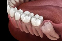 افزایش خطر بروز سکته مغزی با بی توجهی به این بیماری!