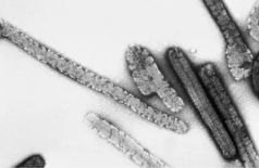 سازمان بهداشت جهانی نسبت به شیوع ویروس کشنده در اتیوپی هشدار داد