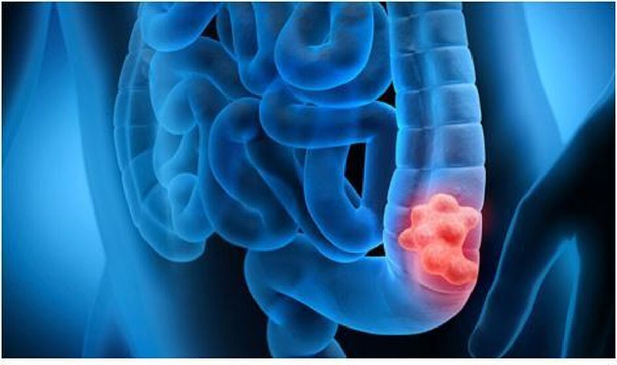 مصرف غذا‌های فرآوری شده چه ضرر و زیان‌هایی برای بدن دارد؟