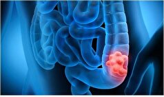 مصرف غذا‌های فرآوری شده چه ضرر و زیان‌هایی برای بدن دارد؟