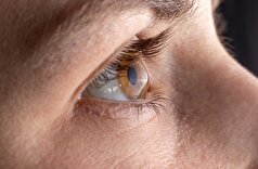 ایرانیان به این بیماری ۱۰ برابر میانگین جهانی مبتلا میشوند!