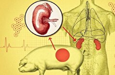 دانشمندان مکانیسم‌هایی را شناسایی می‌کنند که بدن انسان از طریق آنها کلیه خوک اصلاح‌شده ژنتیکی را رد می‌کند