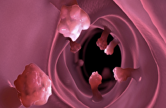 هشدار جدید: غذا‌های فوق فرآوری شده رشد پولیپ‌های روده را که می‌توانند منجر به سرطان شوند، افزایش می‌دهند