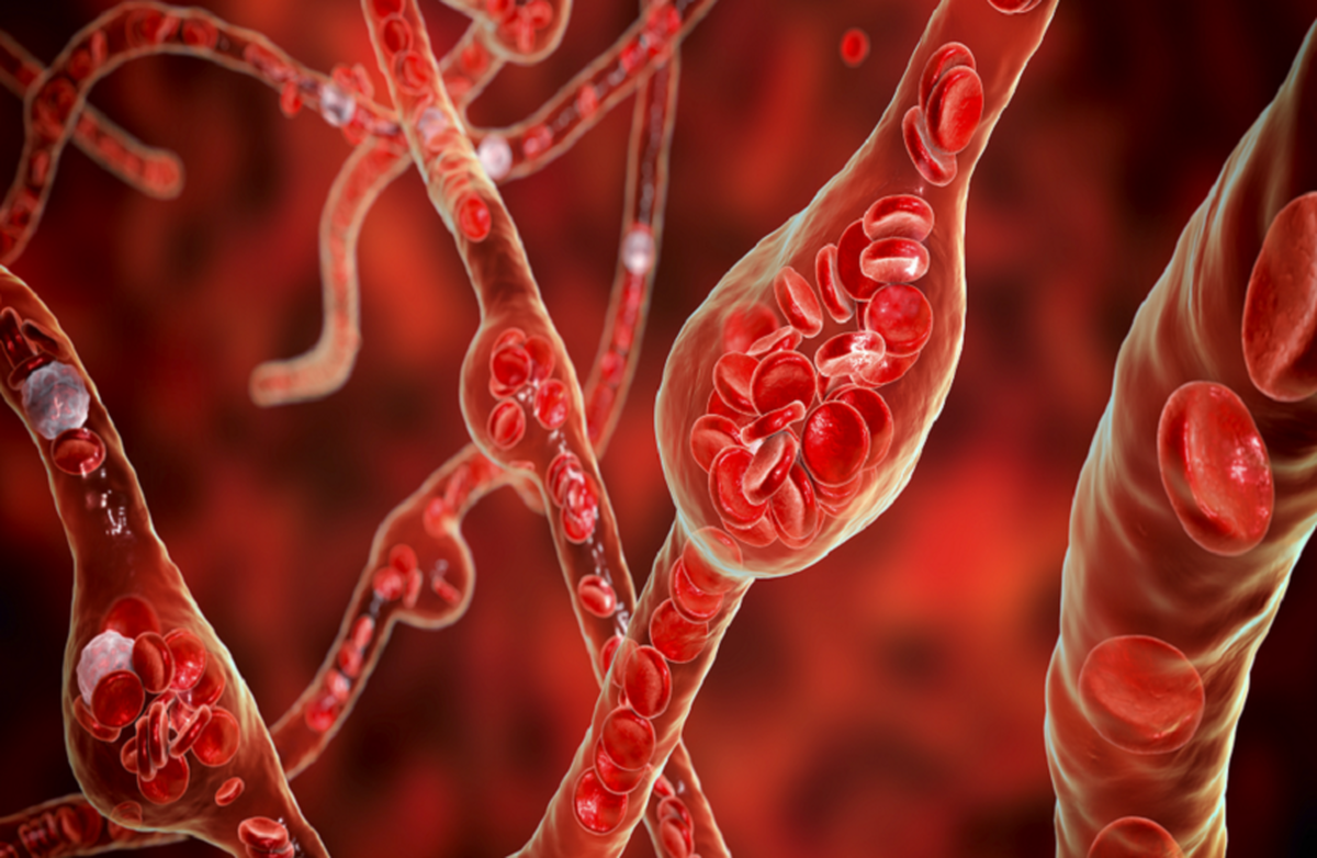 ۴ حقیقت در مورد کلسترول که نباید نادیده بگیرید