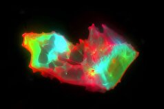 کشف ساختار‌های عجیب و غریب در خون افراد مبتلا به کووید طولانی‌مدت