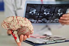 فرضیه قدیمی درمان آلزایمر به چالش کشیده شد!