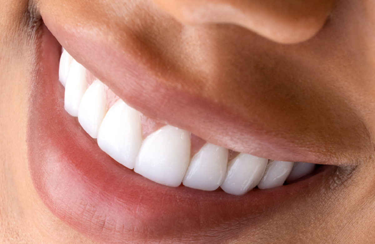 نکات طلایی برای داشتن دندان‌های سفید و درخشان