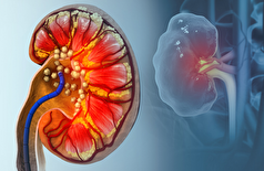 ادرار مار ممکن است راه‌های جدیدی برای درمان نقرس و سنگ کلیه آشکار کند