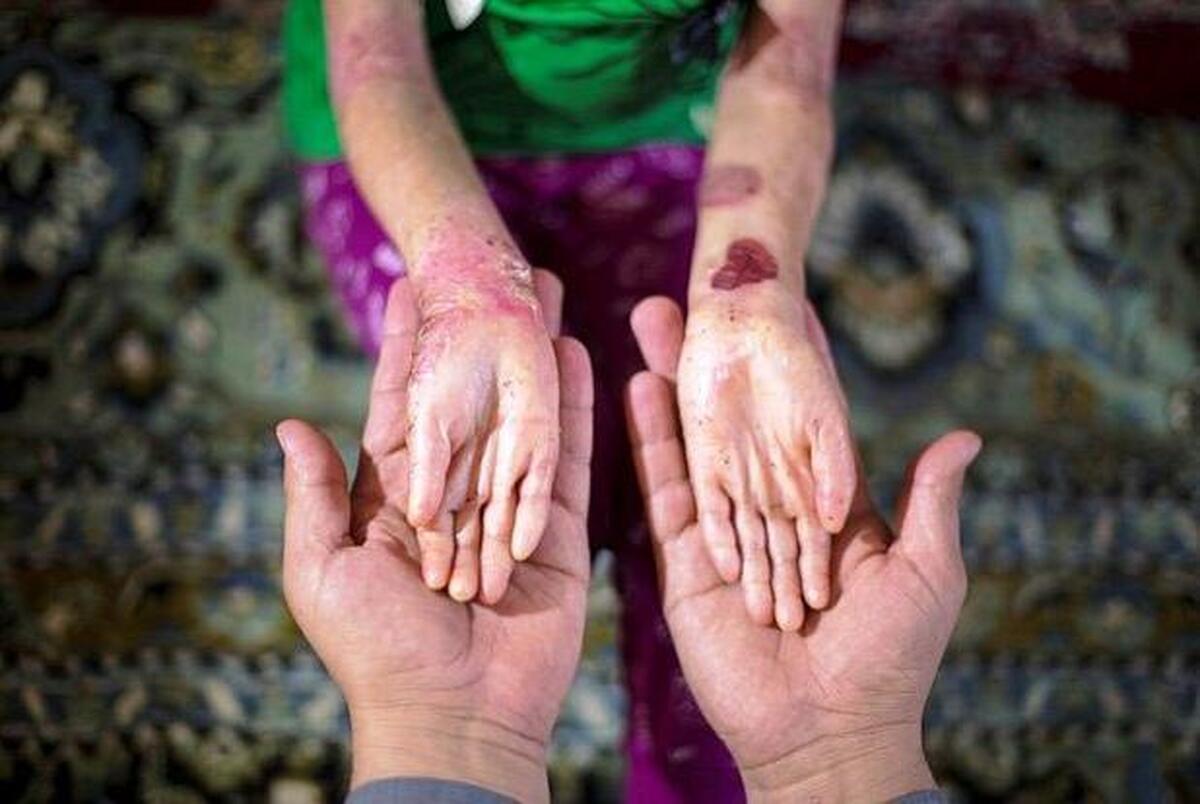 بهترین راه برای شناسایی ژن‌های معیوب پیش از تولد نوزاد چیست؟