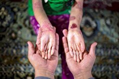 بهترین راه برای شناسایی ژن‌های معیوب پیش از تولد نوزاد چیست؟