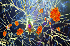 از جمله آنها ویاگرا است... دارو‌های شناخته شده‌ای که ممکن است با آلزایمر مبارزه کنند!