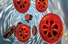 پس از دهه‌ها رکود، یک درمان جدید برای مالاریا نویدبخش یک پیشرفت بزرگ در مبارزه با این بیماری است