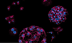 راهی تازه برای مقابله با انگل‌ها به کمک میکروب‌های تک‌سلولی!