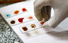 نایاب‌ترین گروه خونی را بشناسید!