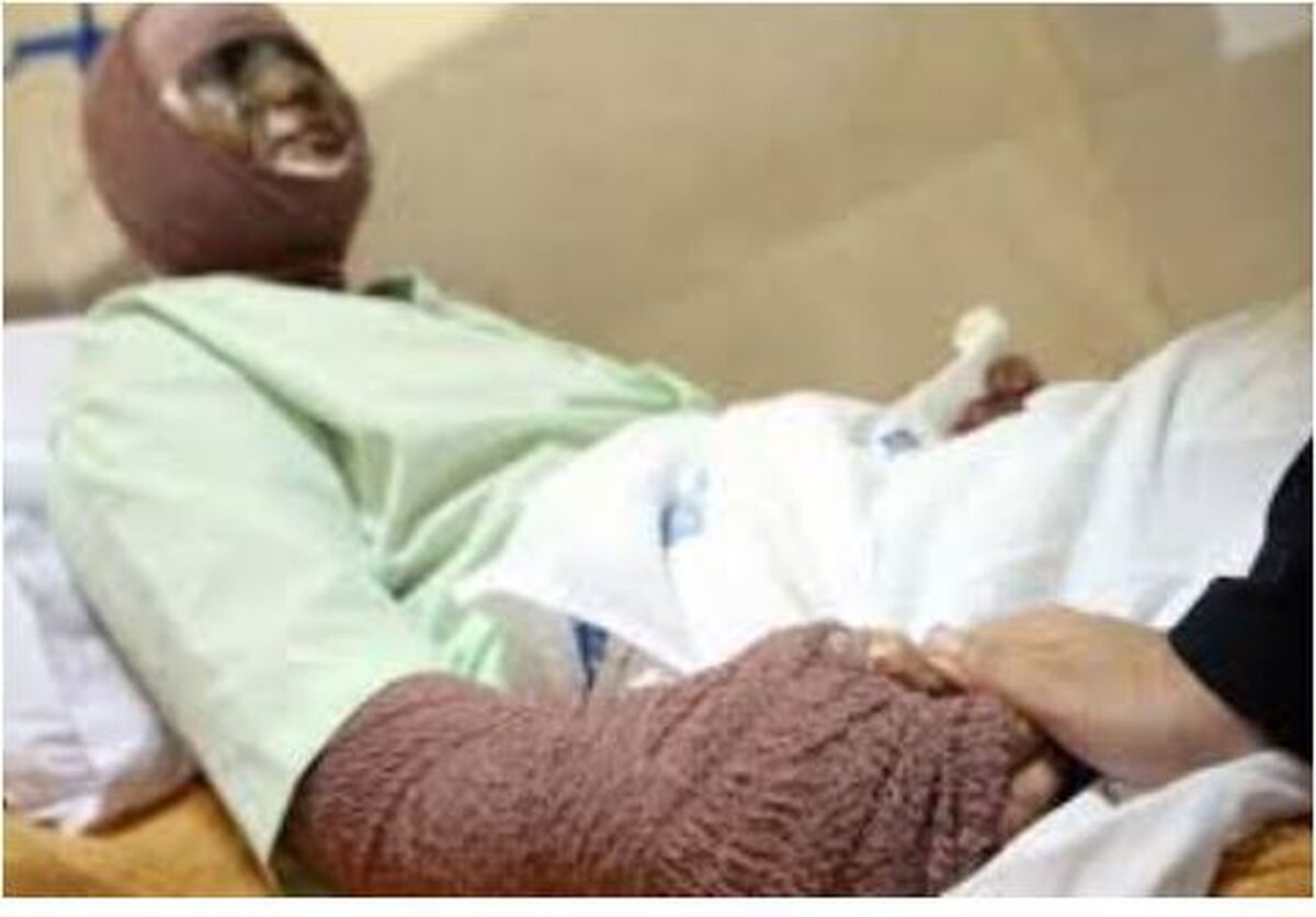 دیگ در حال جوش رب باعث مرگ دلخراش زن جوان شد