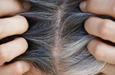 عادت بدی که باعث ریزش مو و سفیدی زودرس مو می‌شود