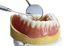 لبخندی همراه با سلامتی... درمان عفونت دندان از قلب محافظت کرده و قند خون را کاهش می‌دهد!