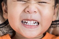 دلیل دندان‌قروچه در خواب و چگونگی برطرف کردن این مشکل!