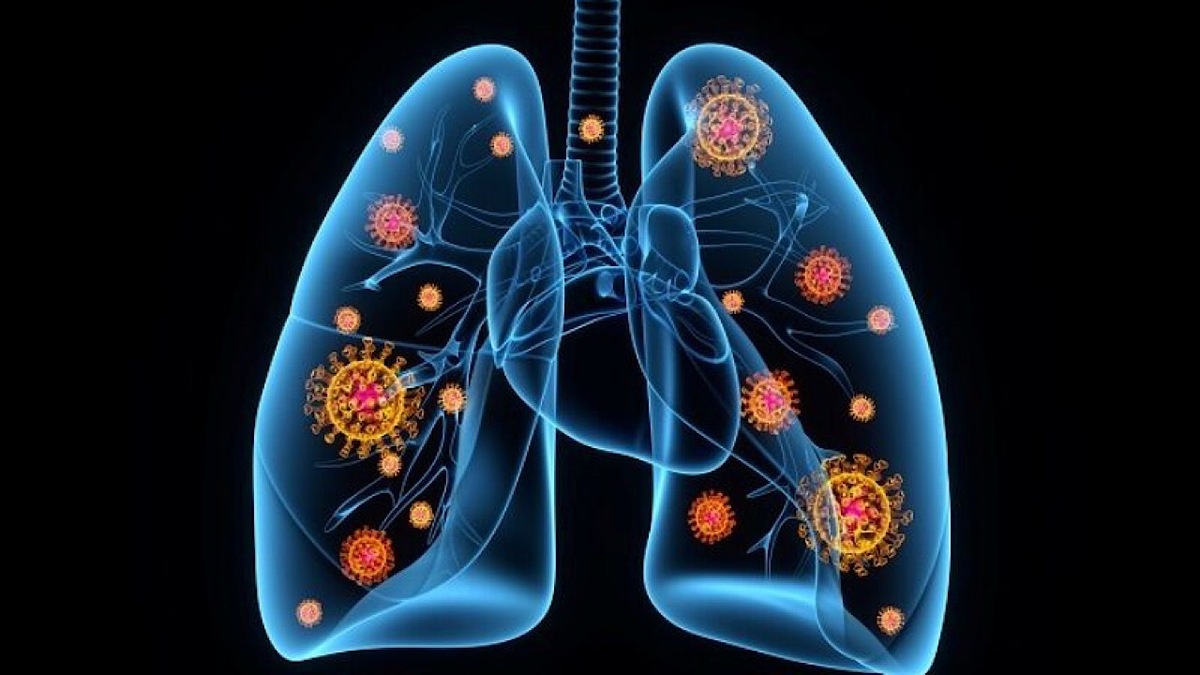 پنومونی همچنان تهدید جدی برای کودکان و سالمندان!