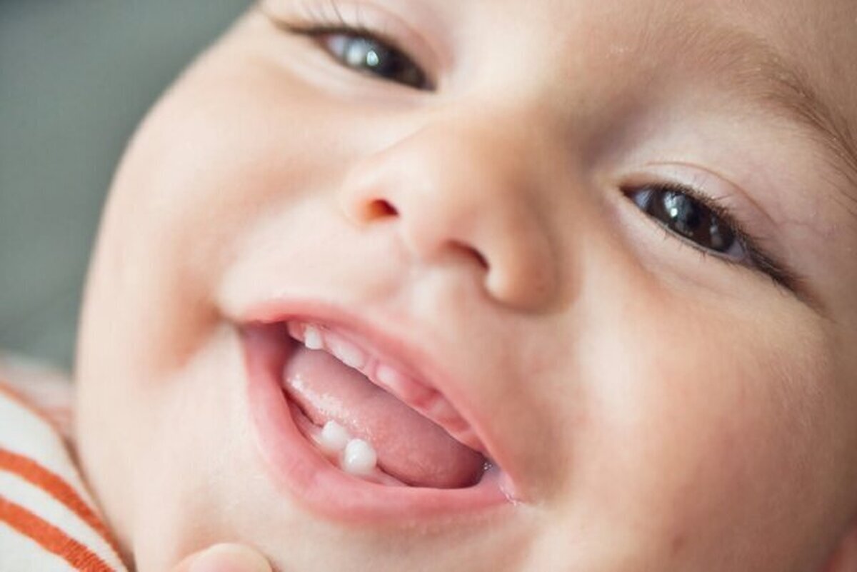 نوزادانی که این ویژگی‌ها را دارند زودتر دندان در می‌آورند