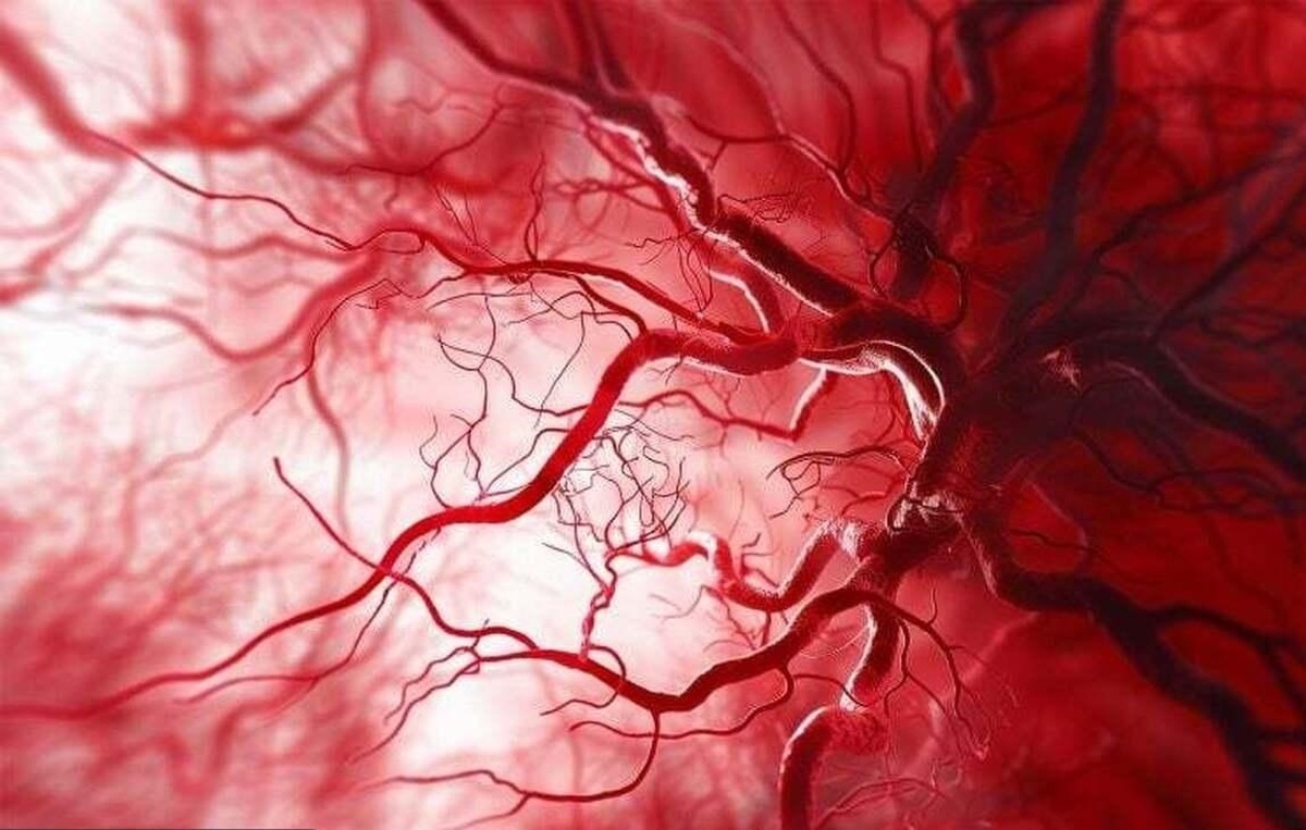 چربی‌های مخفی که میتوانند باعث سکته شوند!